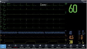 6-lead ECG