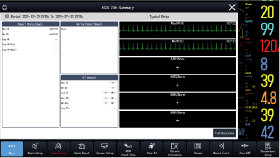 24 hours ECG Summary