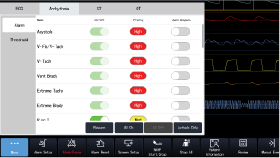 ECG