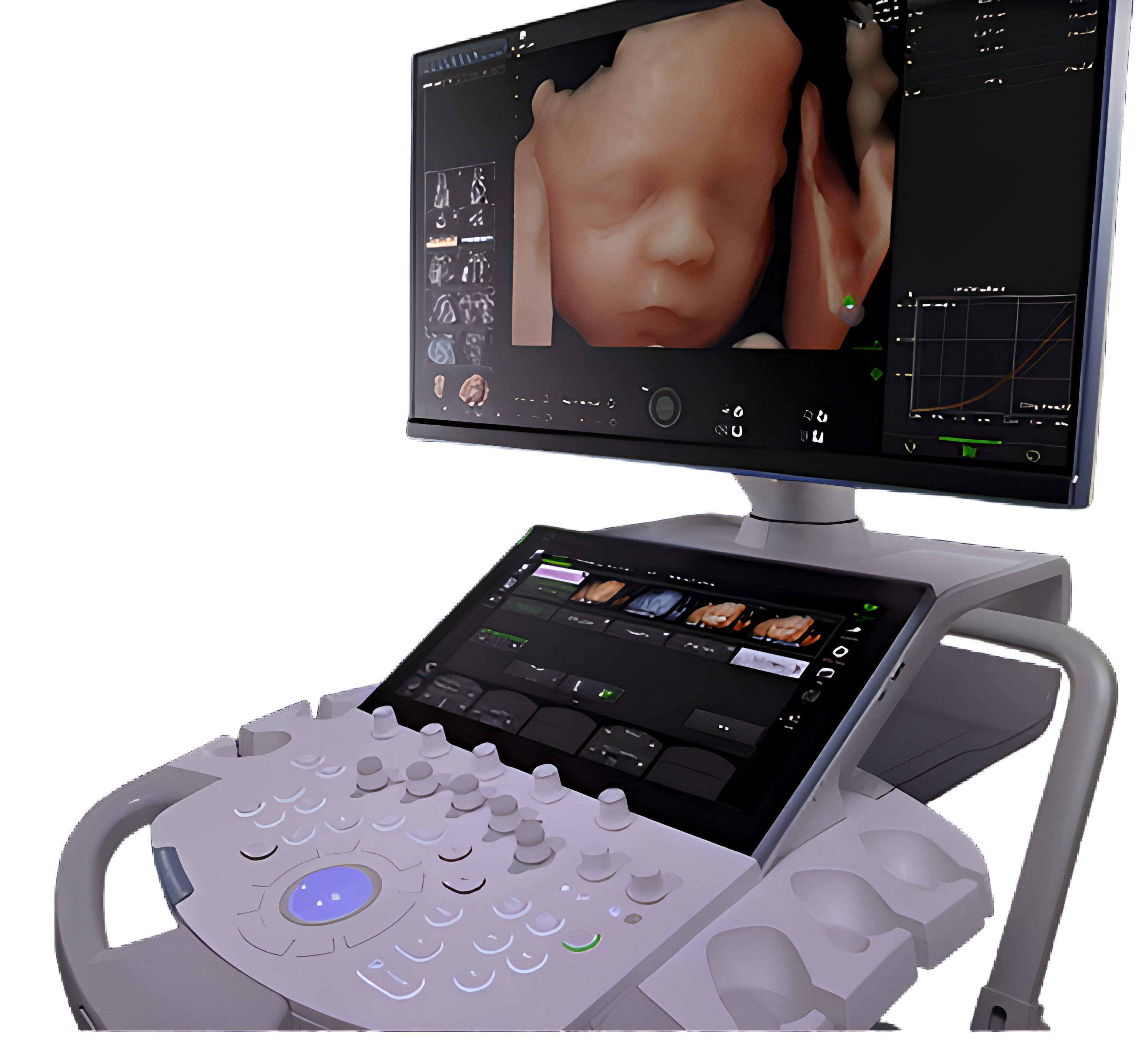 ultrasound