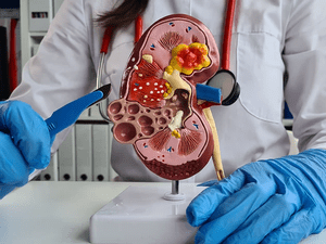 Nephrology_connected 