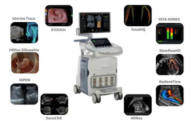 Voluson_E_Series_ultrasound_upgrade