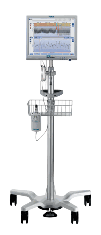 Cerebral Function Monitoring