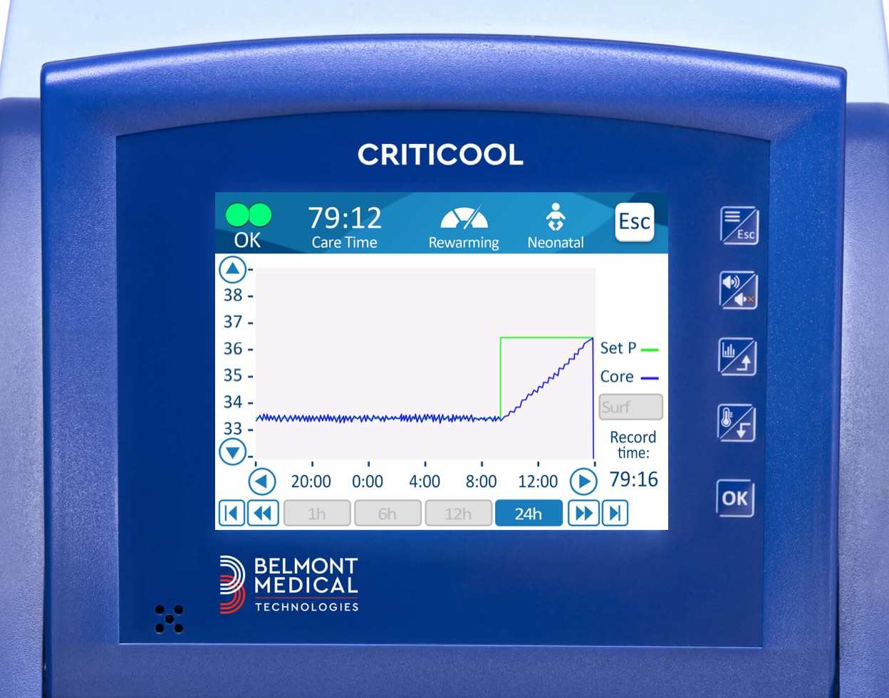 compressed_criticool-feMonitor Patient with color codesature-detail-3