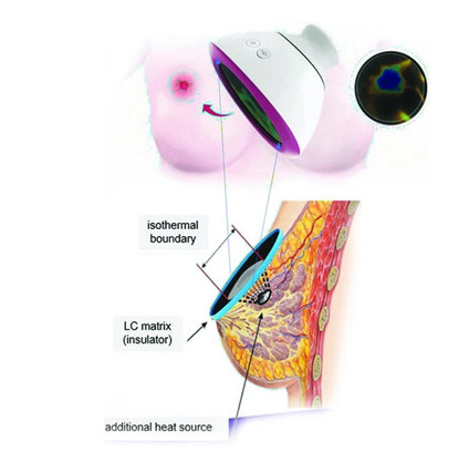 contact_thermography