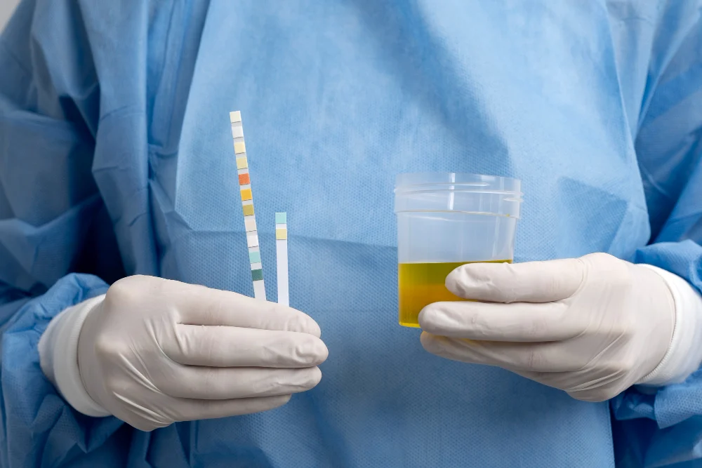 urinalysis