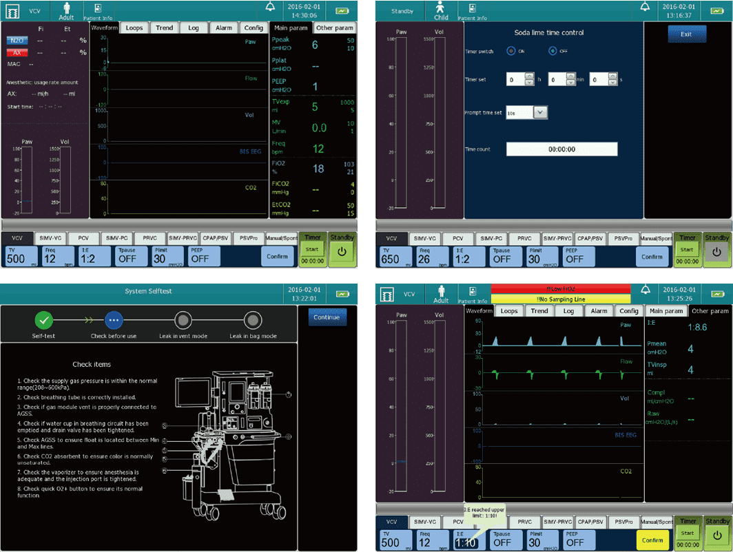 Anesthesia quality control