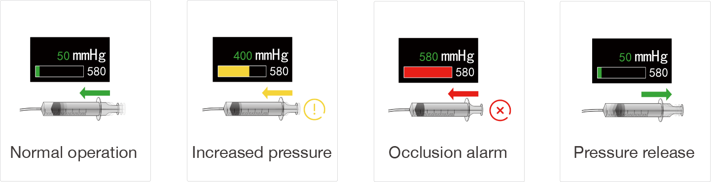 Anti-Bolus self-release system
