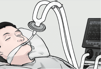 Non invasive therapy